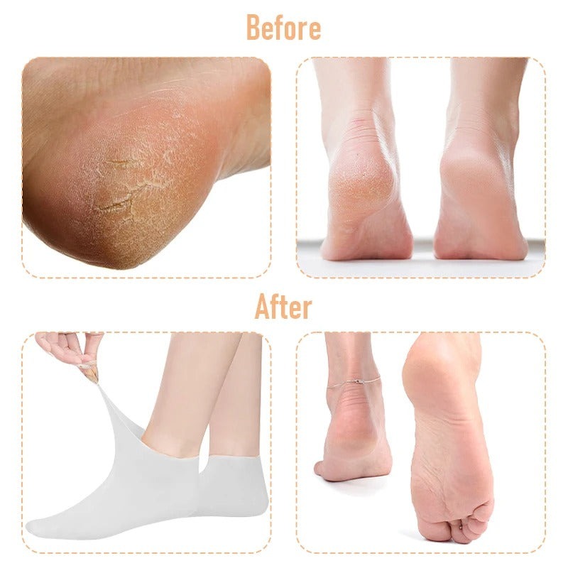 Silicone Gel Socks